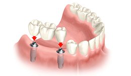 Dr Neethus Smile Care