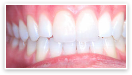 Dr Neethus Smile Care